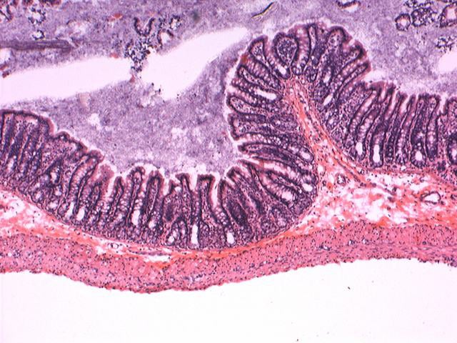 Bright Field 亮字段缩略图