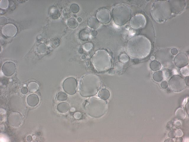 Phase Contrast 相位对比缩略图