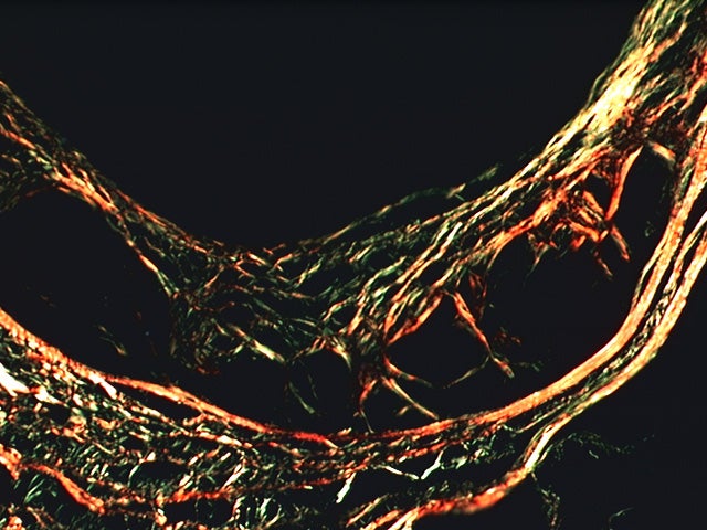 Polarization 极化缩略图