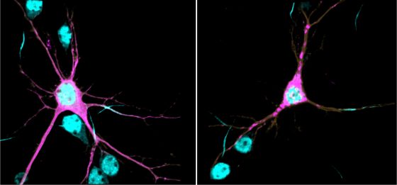 Lorenzo_neurons-560×261